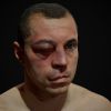 esports boxing club facial damage